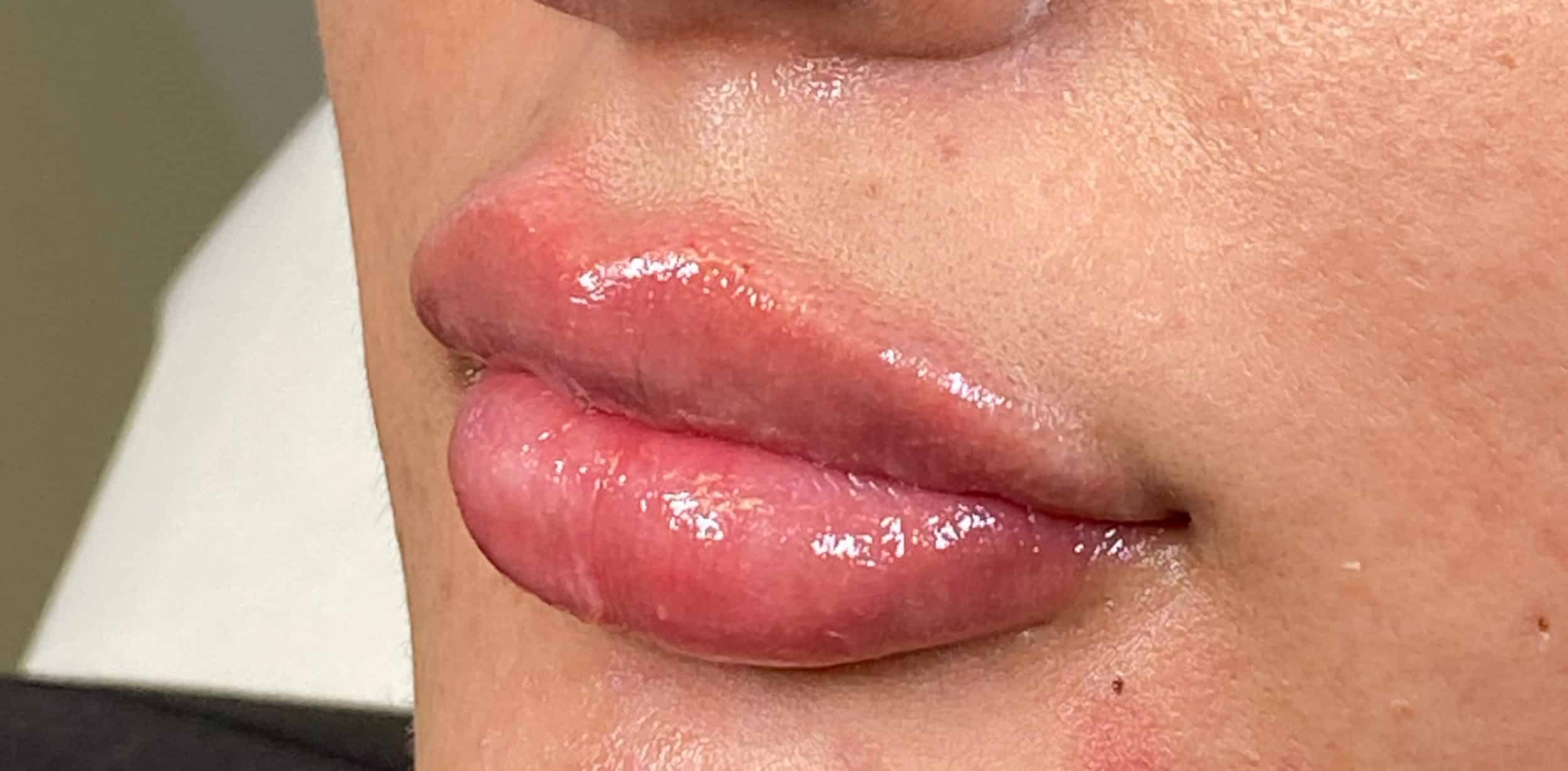 After Image